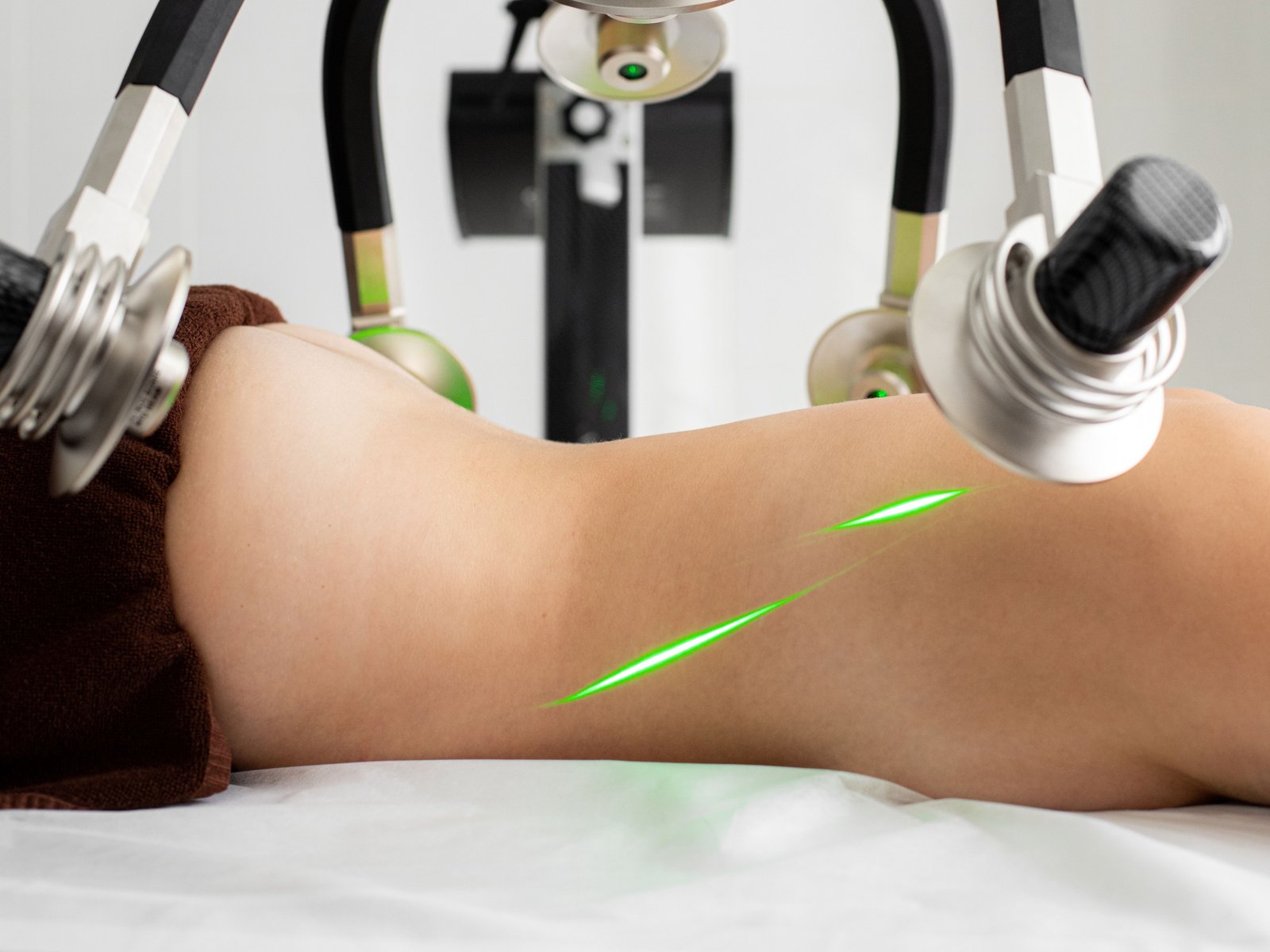 LAZER VE IPL FİZİĞİ – BÖLÜM 2